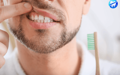 Tout ce que vous devez savoir sur la gingivite