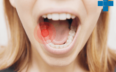 Extraction dentaire à Cagnes-sur-Mer : ce qu’il faut savoir