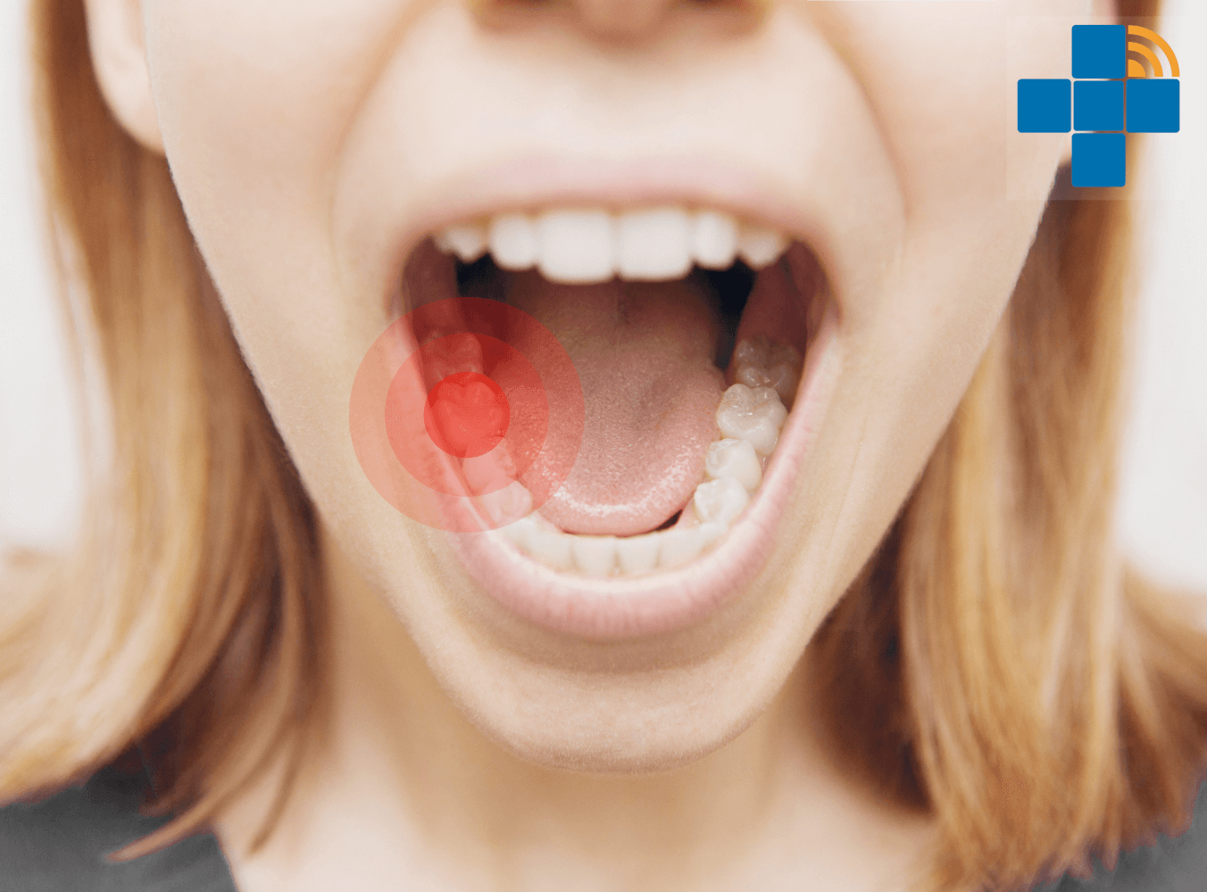 watermarked pathologies dentaires douleur 01 adobe